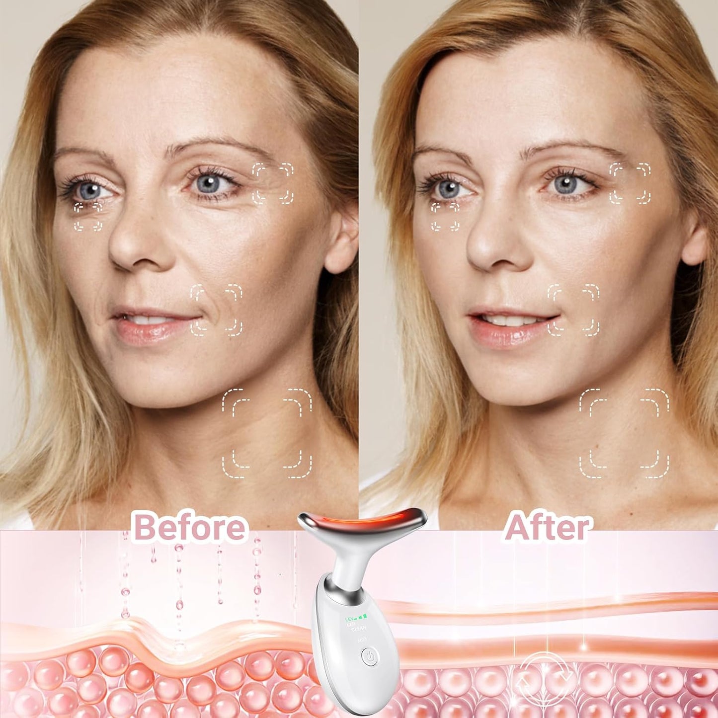 Caro Vault™COLOUR V FACE MASSAGER